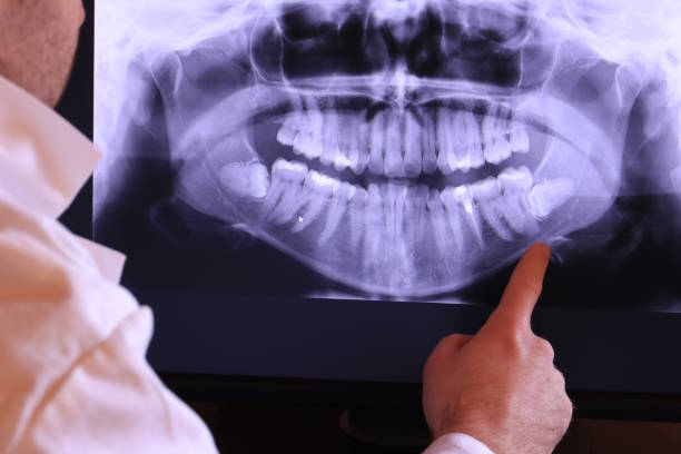 Best Emergency Treatment for Dental Infections or Abscesses in Lawrenceville, GA